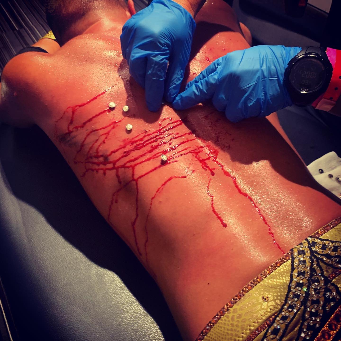 Ricky Starks had a bleeding back on AEW Dynamite this week
