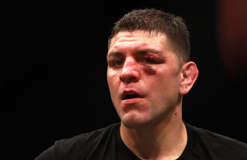 Nick Diaz seems to be planning a UFC return