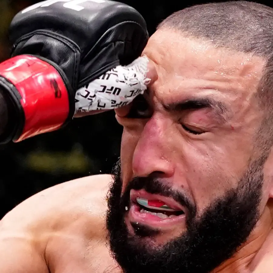 Belal Muhammad suffered a serious looking eye injury after a poke from Leon Edwards