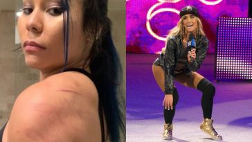 Mia Yim and Carmella were two stars who posted injury and bikini photos