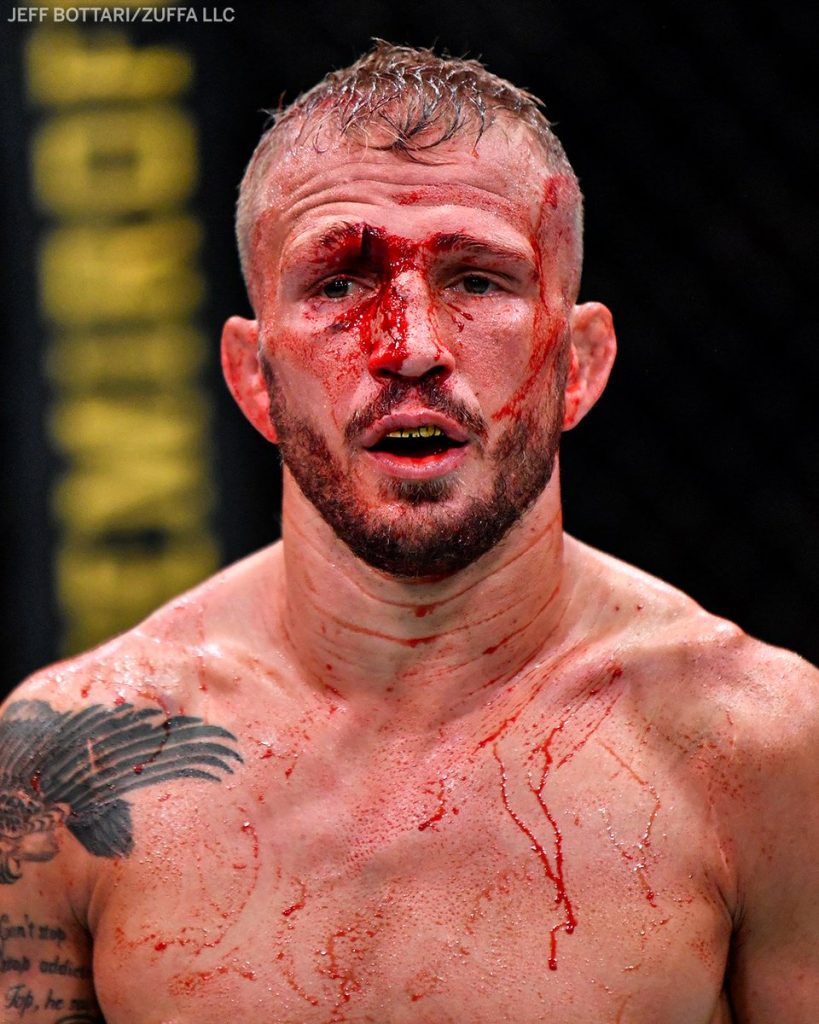 TJ DIllashaw got a nasty eye cut at Vegas 32