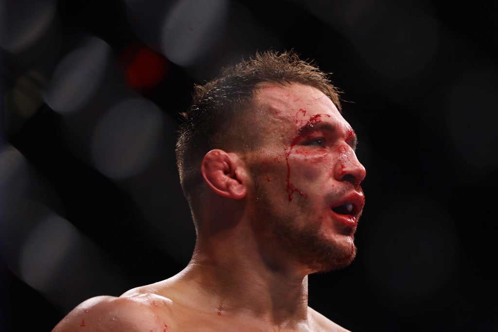 Michael Chandler got his face rearranged by Justin Gaethje