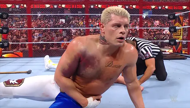 Cody Rhodes injury