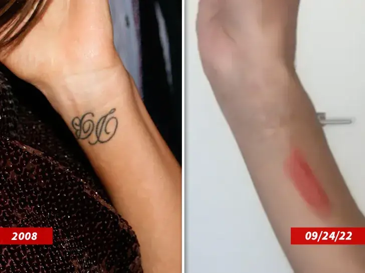 Why did Victoria Beckham get her David Beckham tattoo removed?