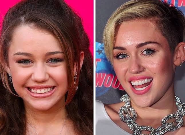 Miley Cyrus' teeth through the years